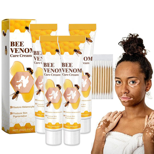 Vitiligo Bee Venom Treatment Cream, Fivfivgo Beevenom Vitiligo Treatment Cream, Bee Venom Vitiligo Cream, for All Skin Types