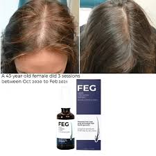 FEG Hair Growth Serum Spray
